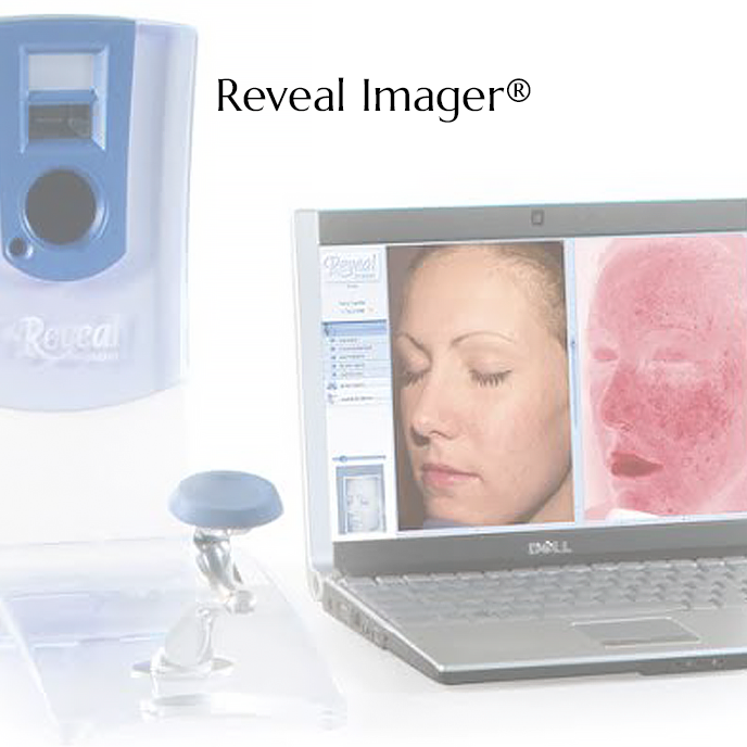 Reveal-Imager